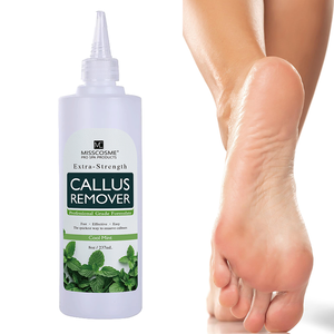 OEM Kallus-Gel Foot Exfoliator Skin Care 237Ml Callus Remover Gel